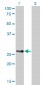 HOXA7 Antibody (monoclonal) (M01)