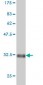 HOXB1 Antibody (monoclonal) (M03)