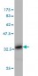 HOXB1 Antibody (monoclonal) (M05)