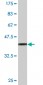 HOXB5 Antibody (monoclonal) (M01)