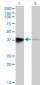 HOXB5 Antibody (monoclonal) (M01)