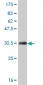 HOXB7 Antibody (monoclonal) (M04)