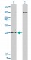 HOXB7 Antibody (monoclonal) (M04)