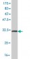 HOXB7 Antibody (monoclonal) (M05)