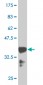 HOXB9 Antibody (monoclonal) (M01)