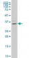 HOXB9 Antibody (monoclonal) (M01)