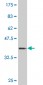 HOXB9 Antibody (monoclonal) (M06)