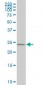 HOXB9 Antibody (monoclonal) (M06)