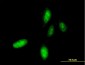 HOXC10 Antibody (monoclonal) (M01)