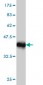 HOXC4 Antibody (monoclonal) (M01)