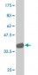 HOXC4 Antibody (monoclonal) (M02)