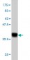 HOXD11 Antibody (monoclonal) (M01)