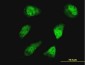 HOXD11 Antibody (monoclonal) (M03)