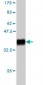 HOXD11 Antibody (monoclonal) (M03)