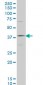 HOXD11 Antibody (monoclonal) (M03)