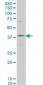 HOXD11 Antibody (monoclonal) (M03)