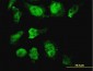 HOXD11 Antibody (monoclonal) (M10)