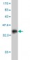 HOXD11 Antibody (monoclonal) (M10)