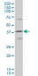 HOXD11 Antibody (monoclonal) (M10)