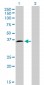 HOXD8 Antibody (monoclonal) (M01)