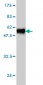 HPRT1 Antibody (monoclonal) (M01)