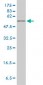 HPRT1 Antibody (monoclonal) (M01)