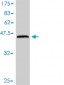 HRASLS3 Antibody (monoclonal) (M01)