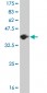 HSD17B1 Antibody (monoclonal) (M03)