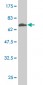 HSD3B1 Antibody (monoclonal) (M01)