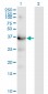 HSD3B1 Antibody (monoclonal) (M01)