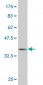 HSF4 Antibody (monoclonal) (M01)