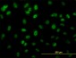 HSGT1 Antibody (monoclonal) (M01)