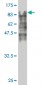 HSGT1 Antibody (monoclonal) (M02)