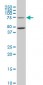 HSGT1 Antibody (monoclonal) (M02)