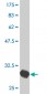 HTR2C Antibody (monoclonal) (M02)