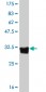 HTR5A Antibody (monoclonal) (M01)