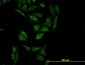 HTRA2 Antibody (monoclonal) (M04)