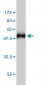 HYI Antibody (monoclonal) (M01)