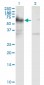 ICA1 Antibody (monoclonal) (M01)