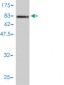 ICAM1 Antibody (monoclonal) (M01)