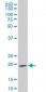 IHH Antibody (monoclonal) (M01)