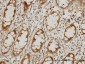 IKBKAP Antibody (monoclonal) (M03)
