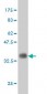 IKBKAP Antibody (monoclonal) (M03)