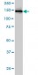 IKBKAP Antibody (monoclonal) (M03)