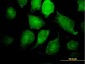 IKBKG Antibody (monoclonal) (M01)