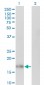 IL10 Antibody (monoclonal) (M03)