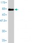 IL11RA Antibody (monoclonal) (M01)