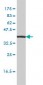 IL11RA Antibody (monoclonal) (M01)