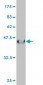 IL13RA2 Antibody (monoclonal) (M01)