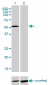 IL13RA2 Antibody (monoclonal) (M01)
